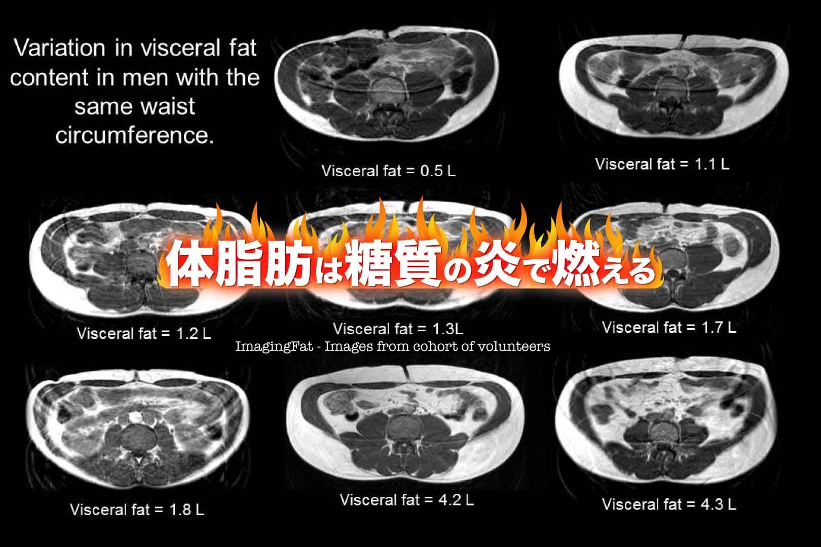 体脂肪は糖質の炎で燃える